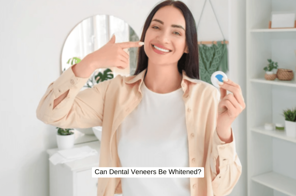 Can Dental Veneers Be Whitened